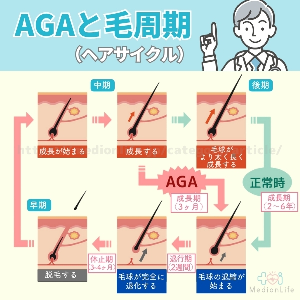 AGAと毛周期