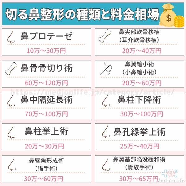 鼻整形 料金相場