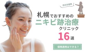 ニキビ跡治療 札幌