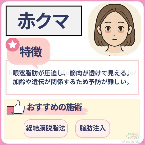 赤クマ