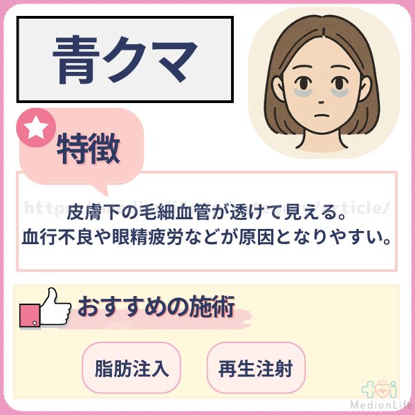青クマ