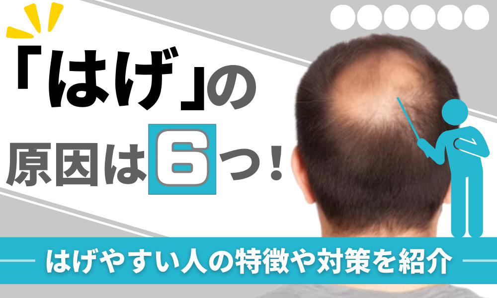 はげ 原因