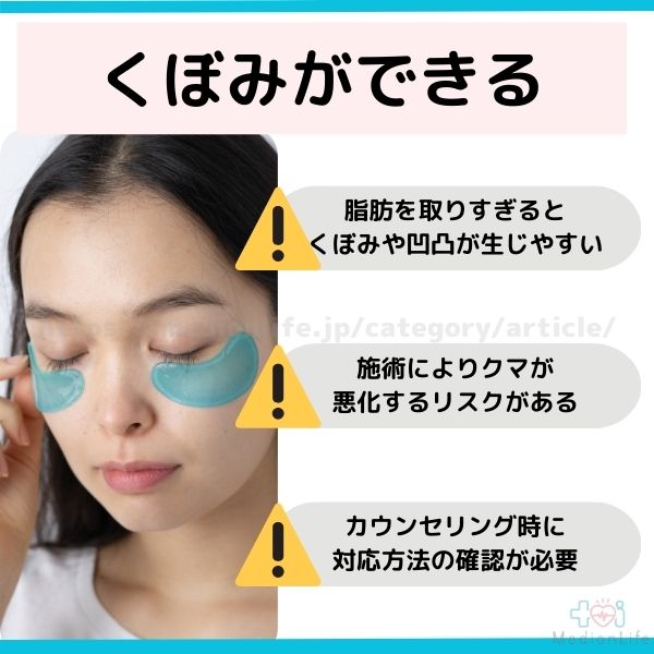 くぼみ