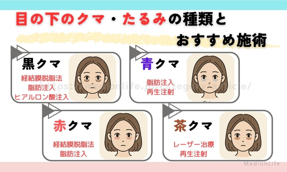 目の下のクマ たるみ