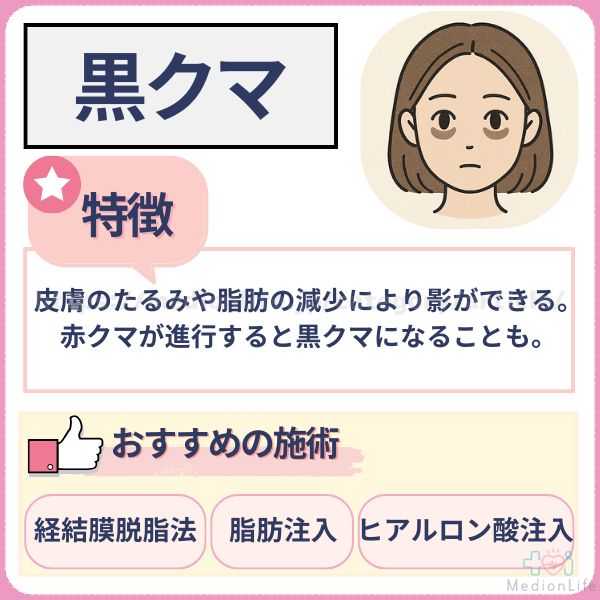 黒クマ