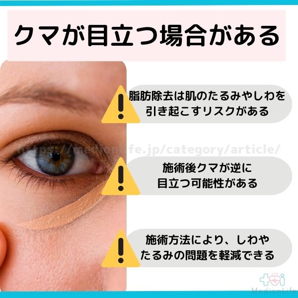 クマが目立つ場合もある