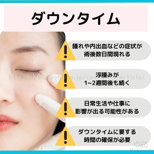 ダウンタイム