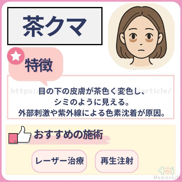 茶クマ