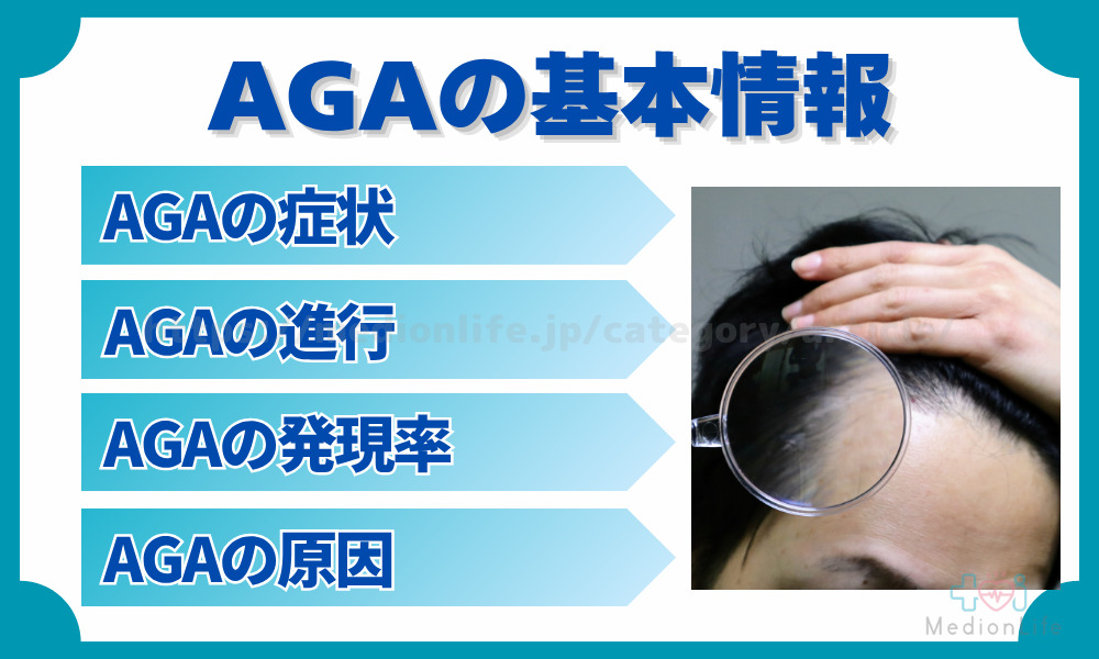 AGAの基本情報
