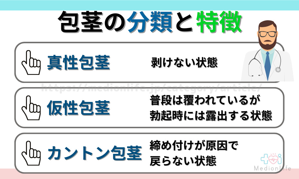 包茎の分類と特徴