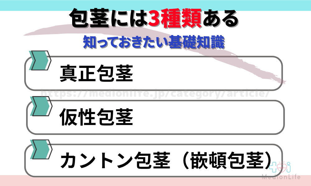 包茎には3種類ある｜知っておきたい基礎知識