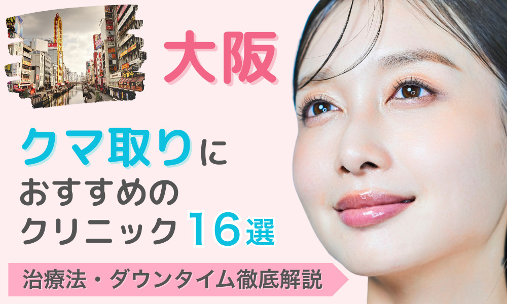クマ取り 大阪