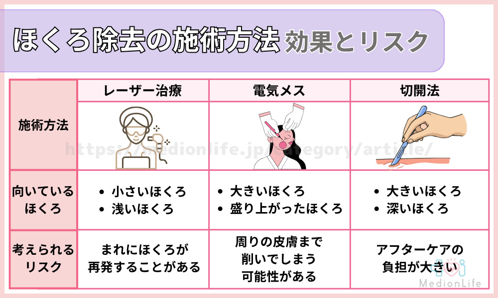 ほくろ除去の施術方法｜効果とリスク